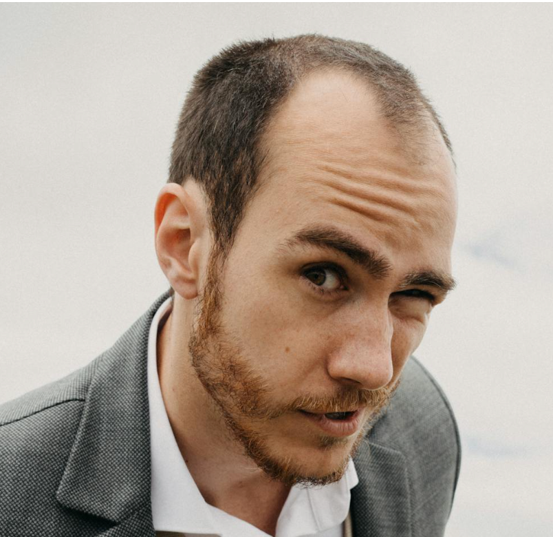 Pourquoi la calvitie impacte plus que vos cheveux (et comment y remédier sans chirurgie)