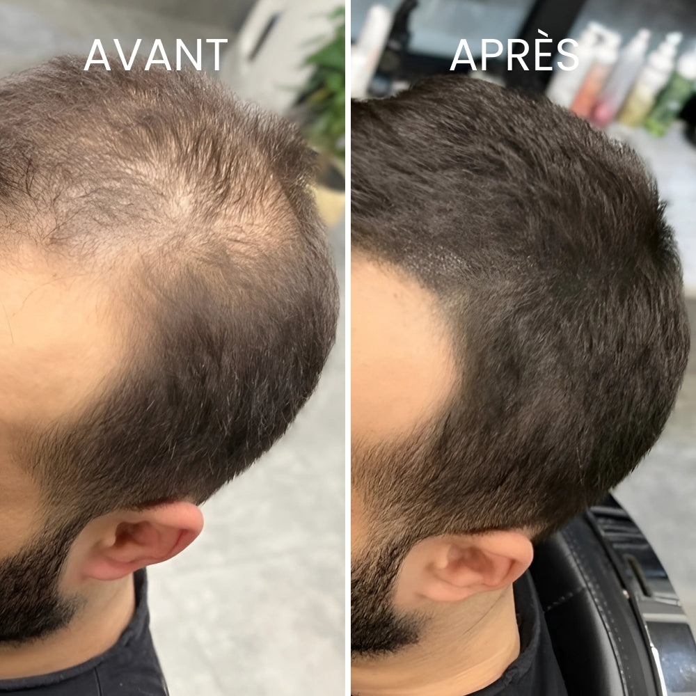 camouflage capillaire BarbaryParis 