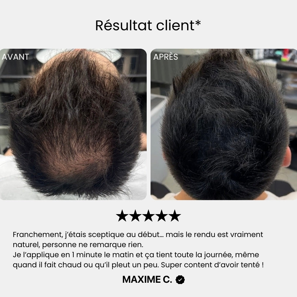 Résultat client de la poudre texture 